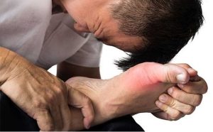 Gout-Symptoms-Causes-and-Prevention-01-300x186.jpg